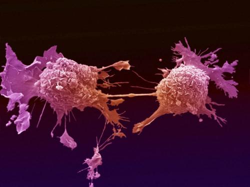 Онкологи нашли уникальный способ борьбы с раковыми клетками