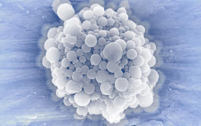 Ученые из Южной Кореи нашли новый способ уничтожения раковой клетки