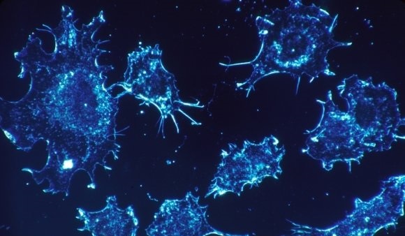 Ученые выяснили, как иммунитет ограничивает разнообразие раковых клеток