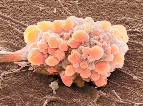 Ученые нашли перспективный препарат против раковых опухолей