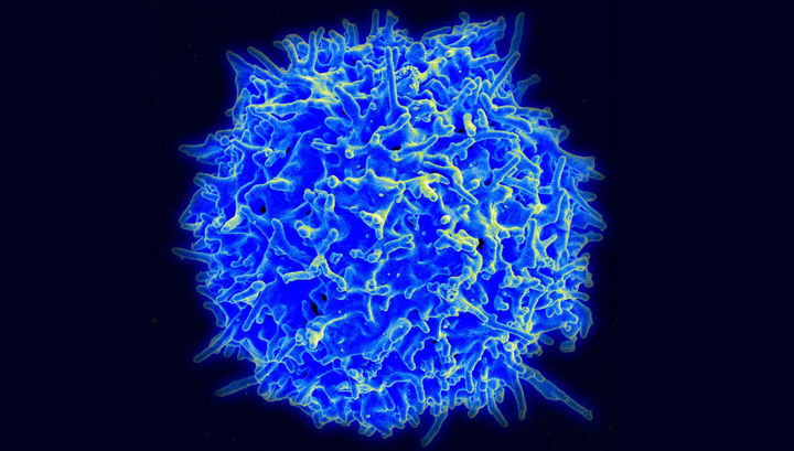 Найдена молекула, заставляющая иммунные клетки эффективнее уничтожать "твёрдый" рак
