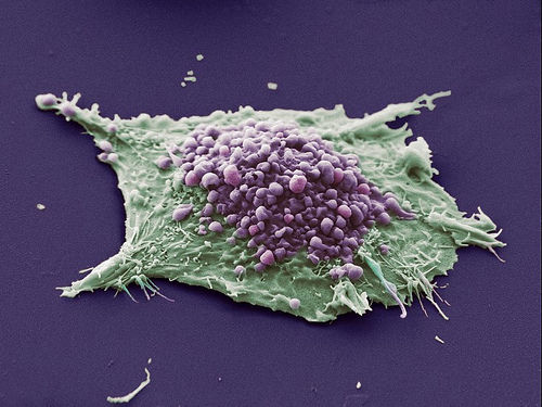 Найден потенциальный способ «усыплять» раковые клетки