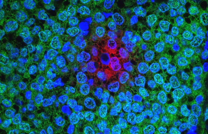 Интеллектуальные наночастицы помогут бороться с раком