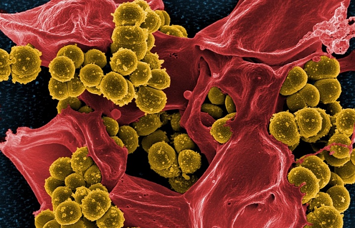Гигиена полости рта поможет защитить организм от развития рака‍