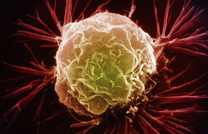 Ученые обнаружили код самоуничтожения раковых клеток