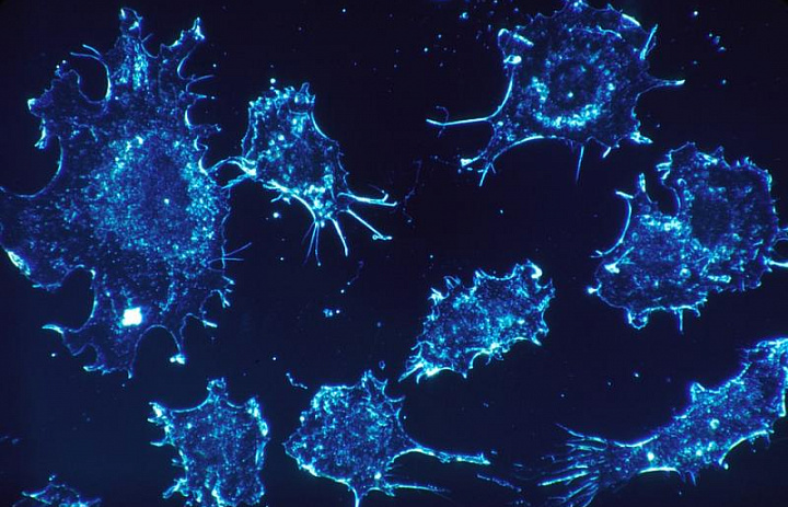 Ученые придумали способ отключения питания к раковым клеткам