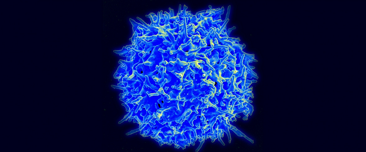Открыты Т-клетки для универсальной и доступной иммунотерапии рака