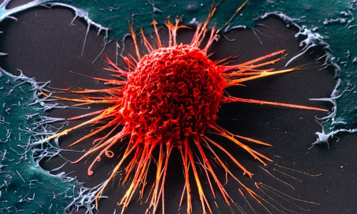 Ученые определили, как наночастицы убивают раковые клетки