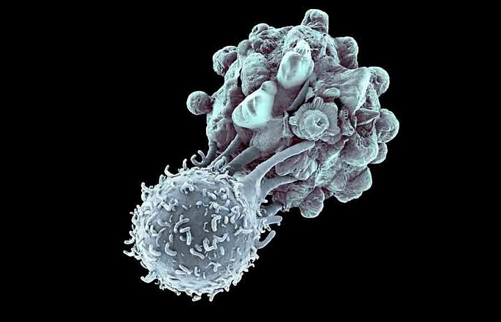 Показано, как иммунные клетки помогают выжить раковым опухолям