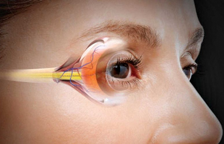 Исследование обнаружило новый механизм, обеспечивающий защиту от глаукомы