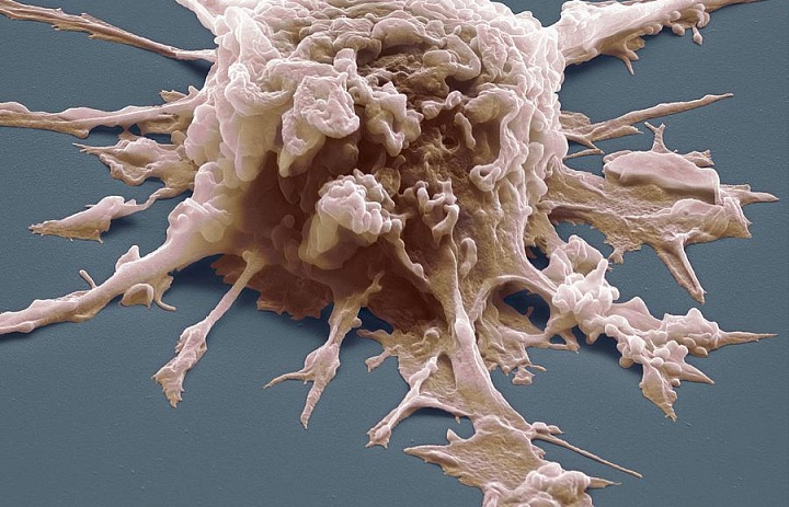 «Умные молекулы» превращают макрофаги в уничтожители раковых клеток