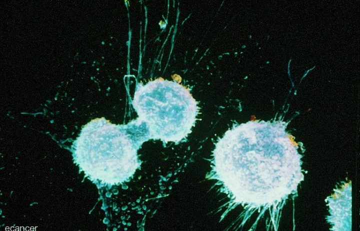 Раковые клетки мутируют против лечения